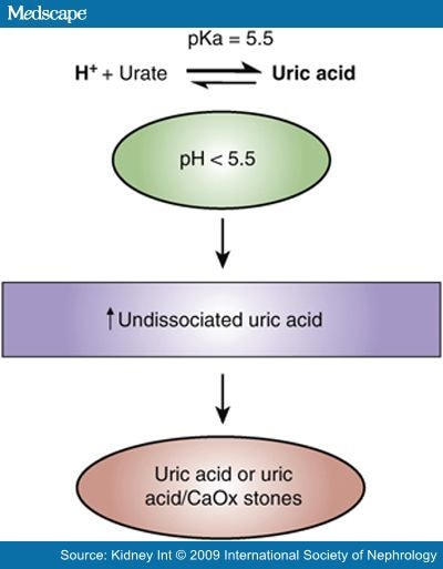 of uric acid stones.