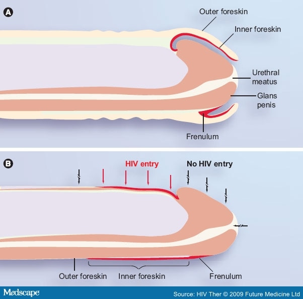 Picture Of A Uncircumsized Penis 52