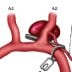 artery of heubner