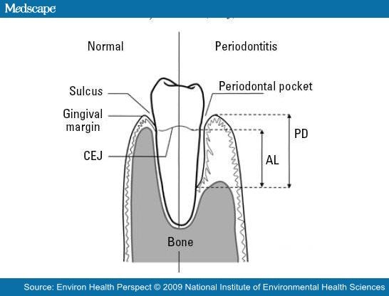 Tooth Cej