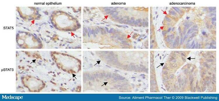 Colon Epithelial Cells