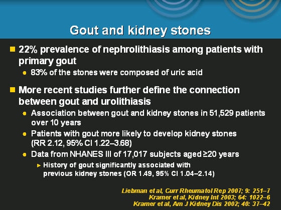 Nephrolithiasis Ultrasound