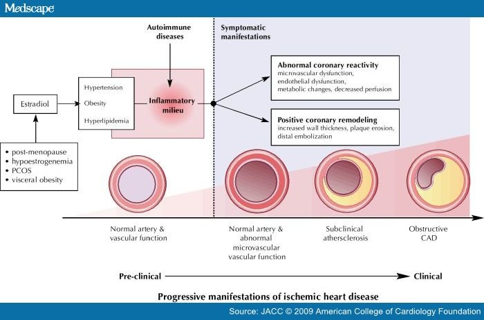 rheumatic heart disease symptoms. Ischemic Heart Disease