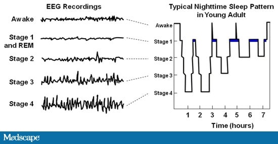 Sleep inertia treatment