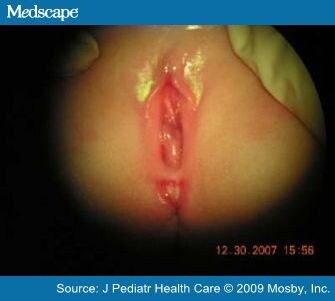 fat wet black asses pics of prepubescent vagina