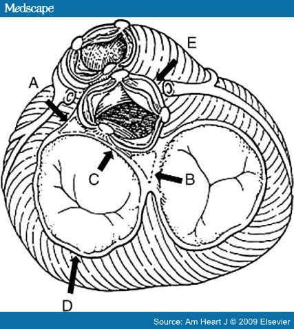 Annulus Area