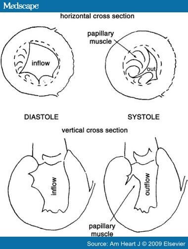 Papillary Muscles Heart