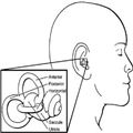 benign paroxysmal positional vertigo benign paroxysmal positional vertigo