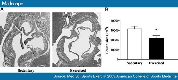 apoe knockout mice