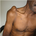 717445-thumb1.png