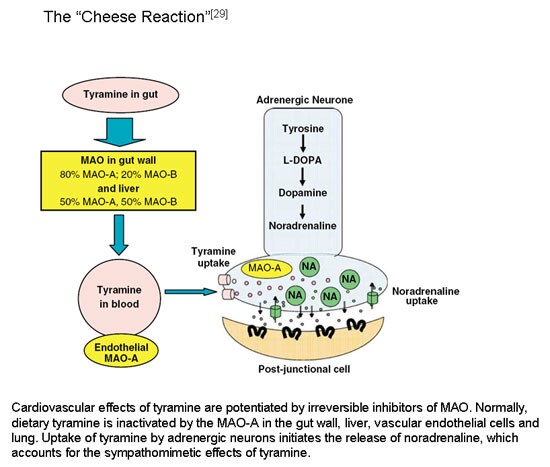 dopamine catabolism