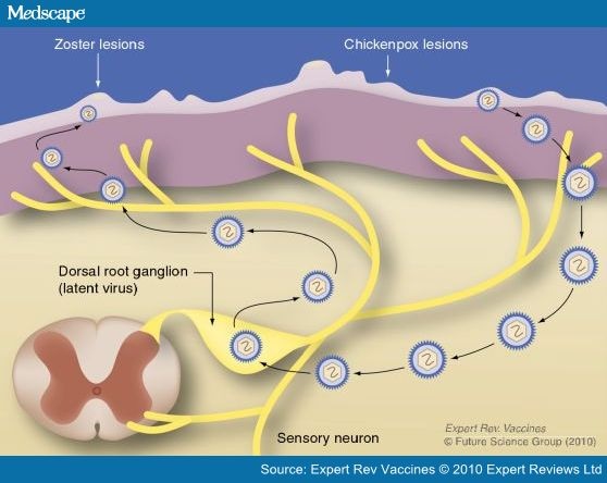 img.medscape.com