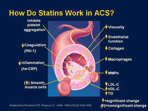 When Low Cholesterol Isn't Enough Assessing Options for