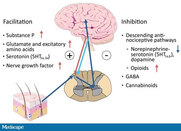 Central Pain