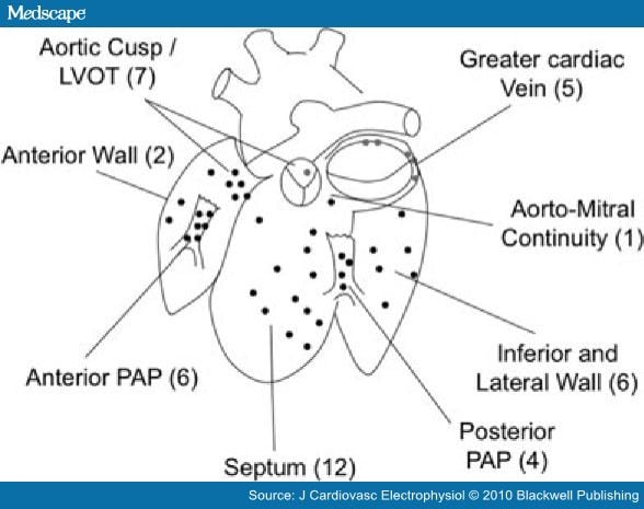 left ventricle ablation flutter