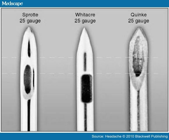 lumbar puncture side effects headache