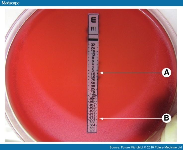 Etest Strips