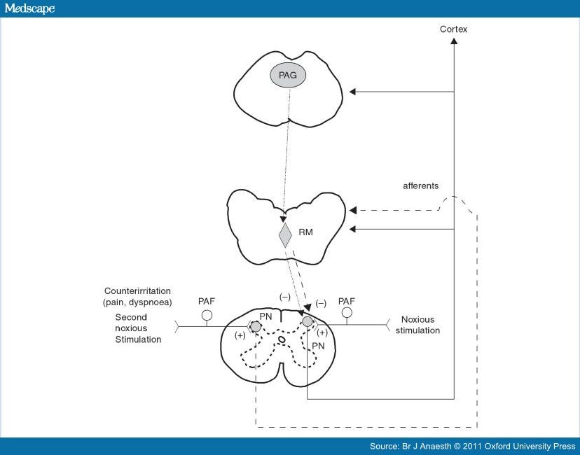 diffuse-noxious-inhibitory-control