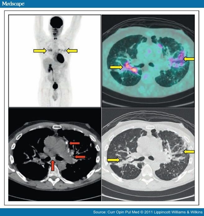 Axial Ct