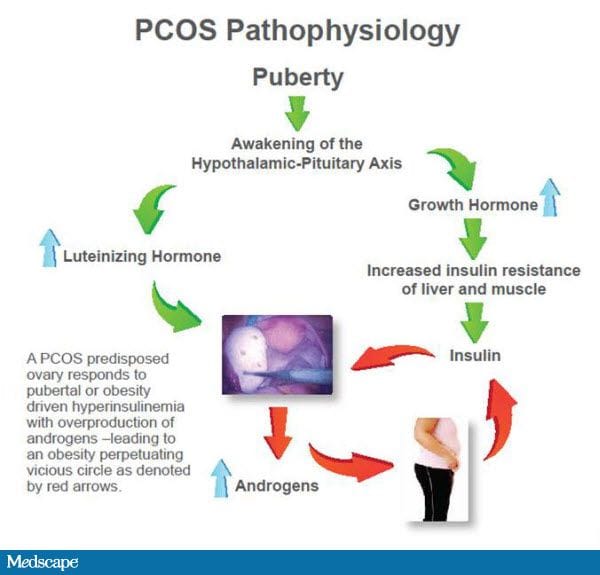 Pcos And Insulin Resistance