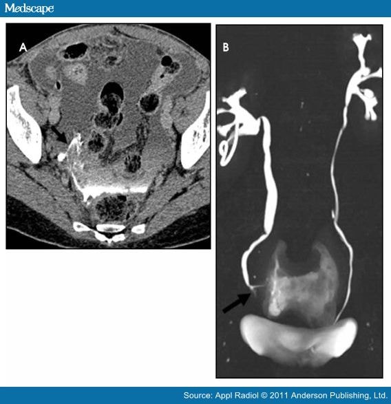 ct urogram vs cystogram