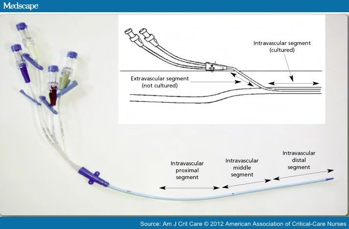 Microbial Colonization on Surfaces of Intravascular Devices