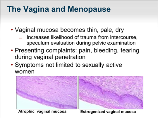 Menopausal Symptoms: What, When, And How To Treat? (transcript)