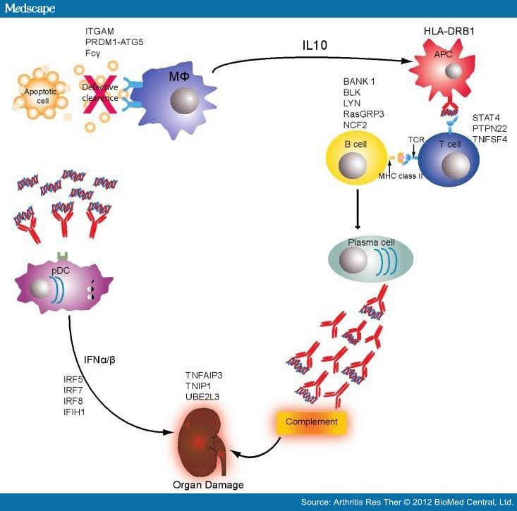 The Genetics Of Lupus