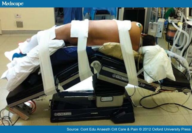 pics for gt lateral decubitus position for nephrectomy pics for gt lateral decubitus position for nephrectomy
