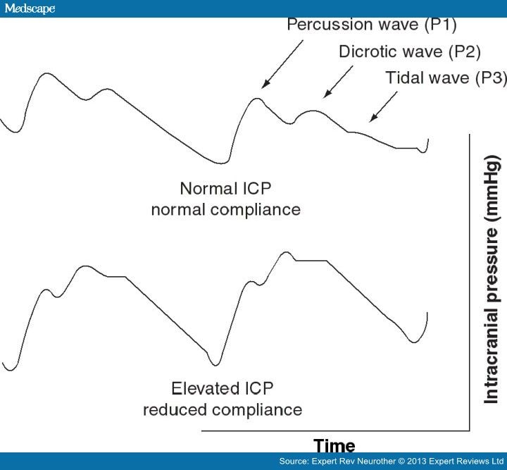 New Approaches To Bedside Monitoring In Stroke