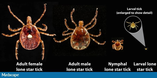 Southern Tick Associated Rash Illness