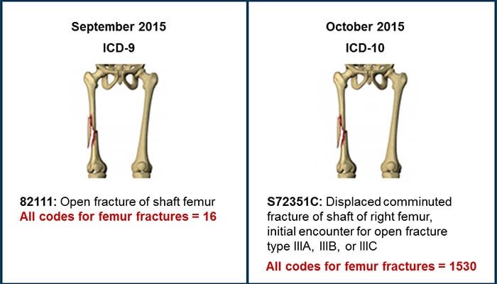 left hip intertrochanteric fracture icd 10