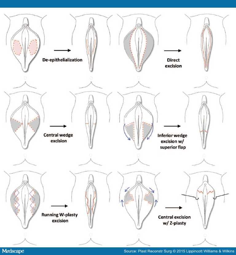 vagina shapes front and bottom