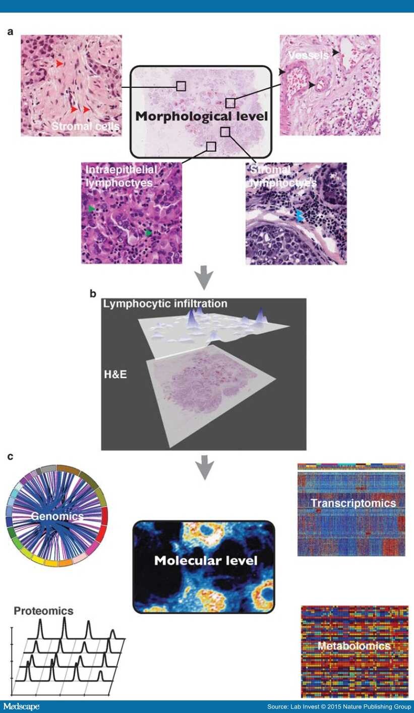 Mapping Spatial Heterogeneity In The Tumor Microenvironment