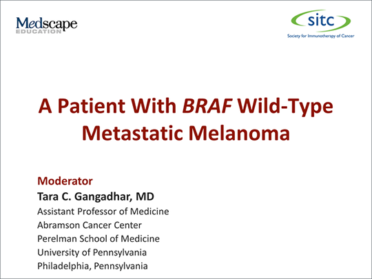 A Patient With BRAF WildType Metastatic Melanoma (Transcript)