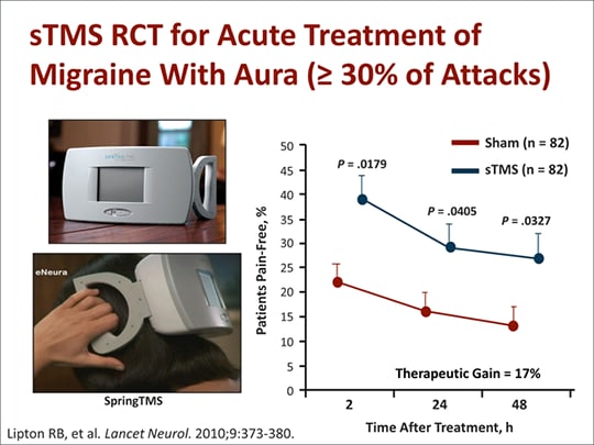 treatment for migraine with aura