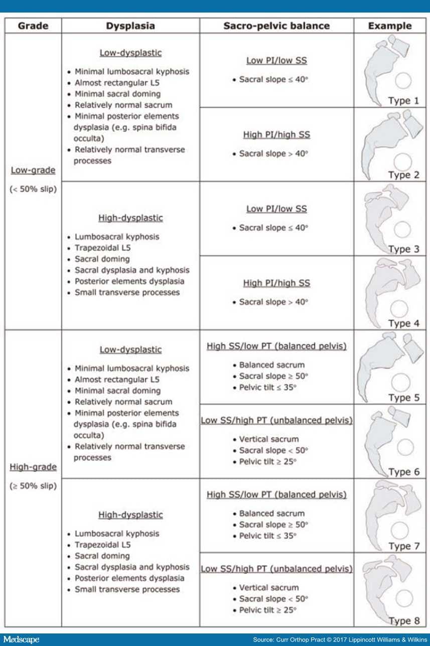 spondylolisthesis grades