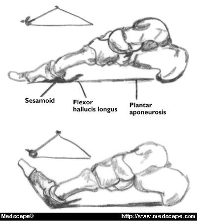 The tibial nerve divides at Tibial Nerve Innervation. The tibial nerve divides at