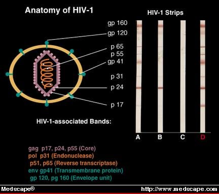 western blot hiv
