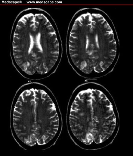 mri brain scan. makeup MRI brain scan mri