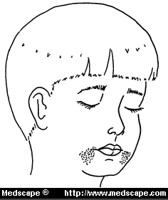 Mouth Rashes
