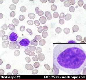 large lymphocyte