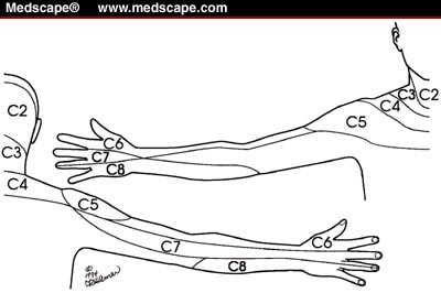 Cervical Nerve Roots