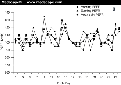 Diurnal Variation Asthma