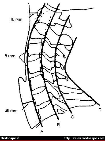 bony thorax diagram. Diagram of four lordotic lines