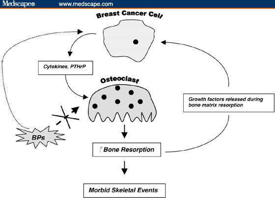 breast cancer cells. Breast cancer cells release