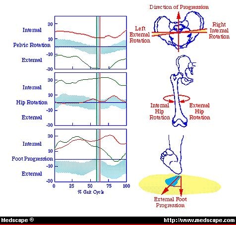 Foot Progression Angle