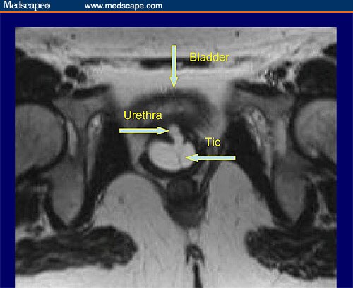 Krinskys Case Challenge Case X Pelvic Mass In A Young Wo