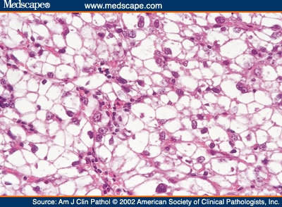 Methyl Green Stain