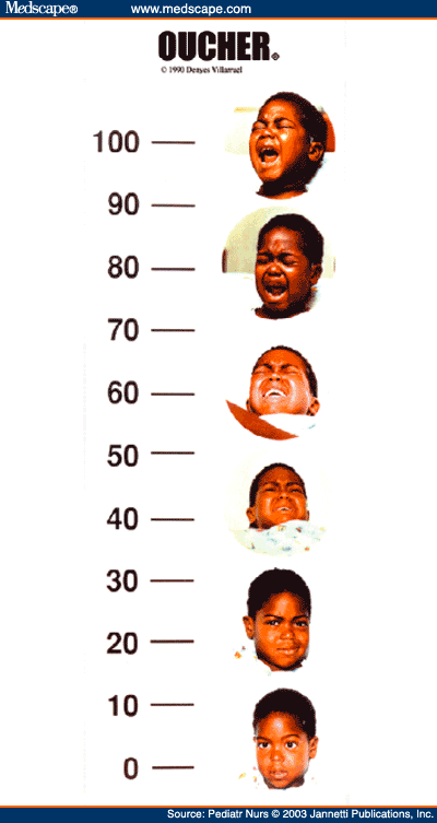 Oucher Pain Scale